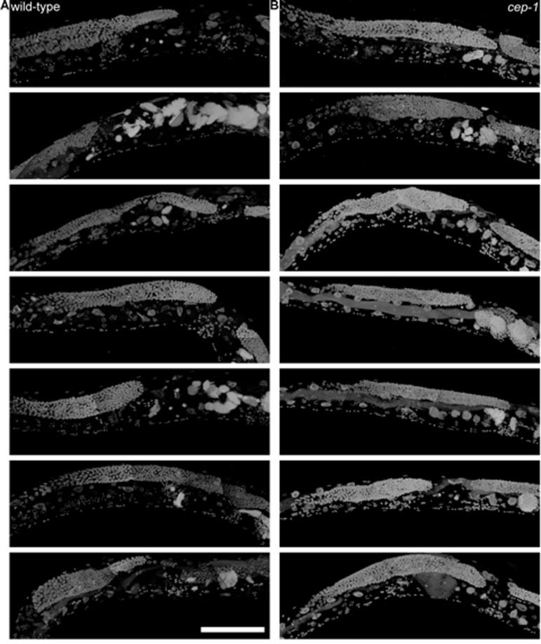 8-day-old wild-type and cep-1 worms have visibly detectable masses