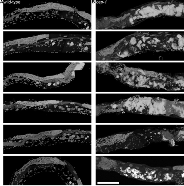 cep-1 worms have earlier uterine mass onset