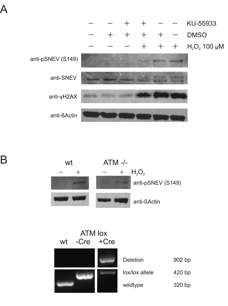 Phosphorylation of SNEV at S149A is ATM-dependent