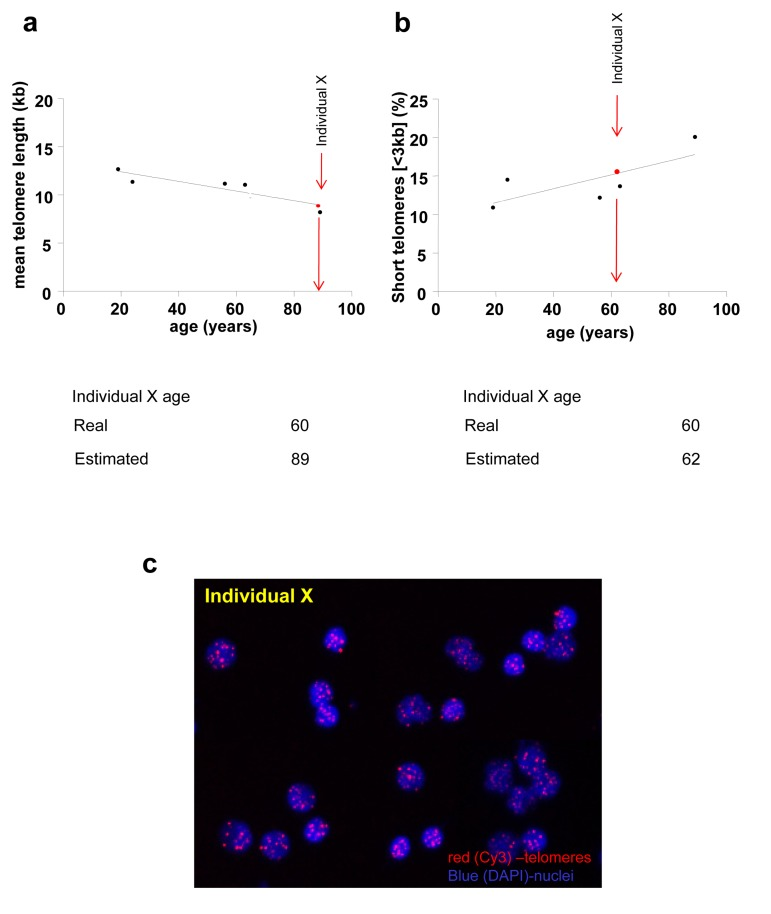 Biological age estimation from a given mean telomere length (a) or a percentage of short telomeres (b) of a given individual (Individual X)