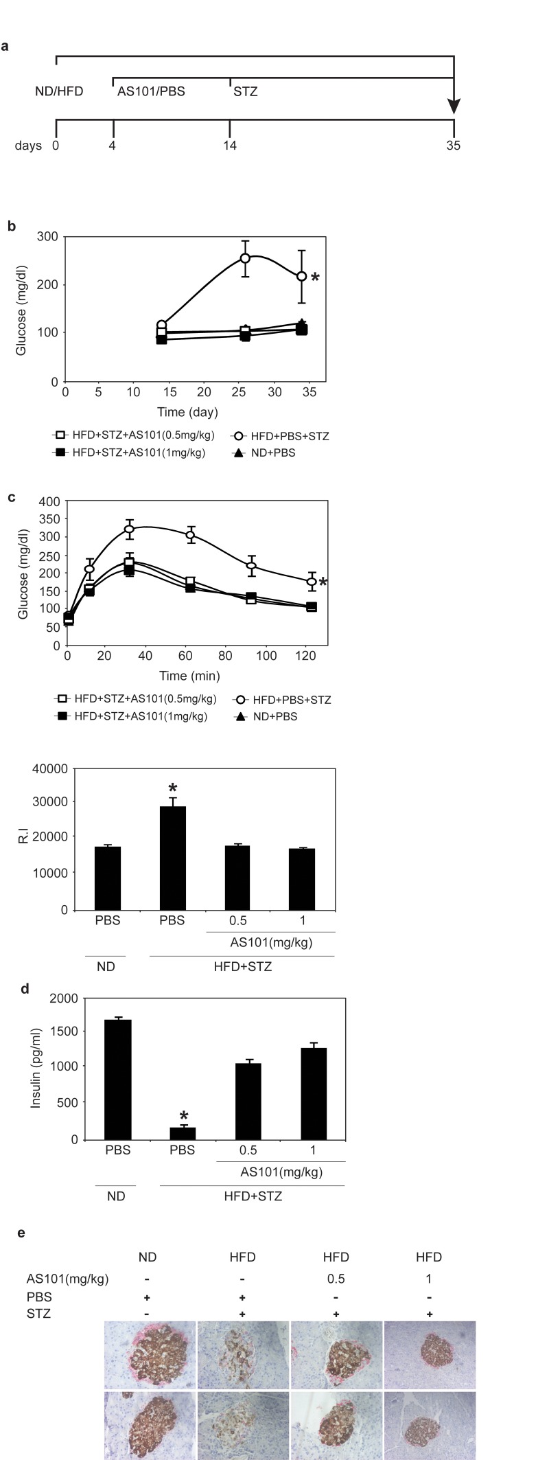 AS101 reverses HFD+STZ induced T2D