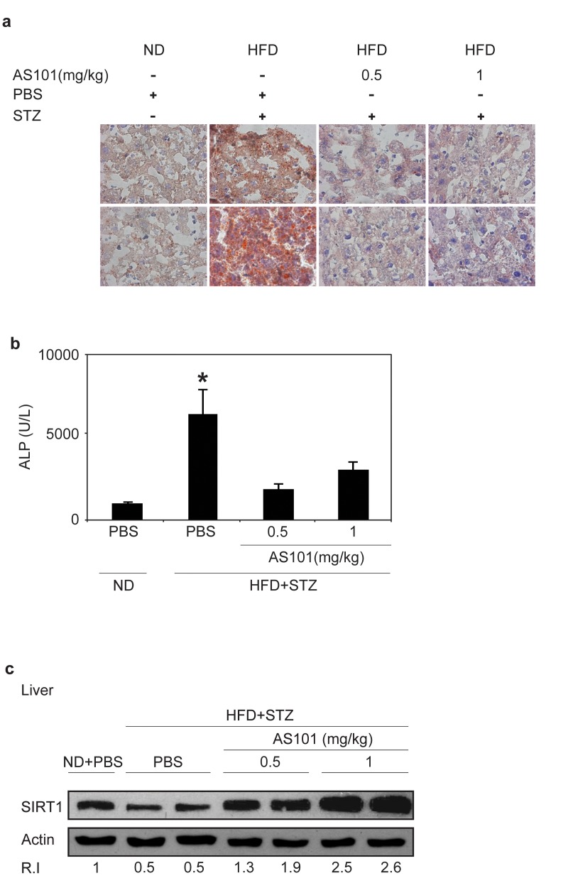 AS101 treatment protects rats from HFD+STZ induced hepatosteatosis