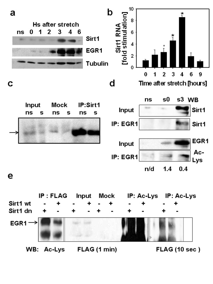 (a) C2C12 myotubes were cultured on 7 FlexCell plates, 6 plates were subjected to 30 min stretch while a set of myotubes was kept without stretch (ns), stretched myotubes were harvested at different times after stretch from 0 to 6 hours. 80 μg of total protein from each sample and molecular weight markers (MW) were subjected to SDS-PAGE and Western blot with antibodies against SIRT1, EGR1 and tubulin. Molecular weight markers positions are displayed on the left of the western blot scan images. (b) SIRT1 RNA content was determined by RT-real time PCR in stretched and non-stretched myotubes by RT-real time PCR and fold stimulation represents the stretched/non-stretched SIRT1 RNA content ratios (*indicates statistical significant difference from non-stretched) (c) Stably expressing FLAG-EGR1C2C12 cells (C2C12 12.4 clone) were plated in flexible bottomed plates and a set of cells were stretched (s) whereas another set was used as non-stretched controls (ns). Total proteins were obtained 3 hours after stretch; 0.5 mg of protein were incubated with protein A/G agarose beads loaded with a rabbit SIRT1 antibody or without antibody (mock); 50μg of total protein (input) and mock and SIRT1 immunoprecipitates were subjected to SDS-PAGE and Western blot with a monoclonal anti-FLAG M2 peroxidase conjugated antibody (Sigma-Aldrich). (d) Total proteins (0.4 mg) from non-stretched myotubes (ns), myotubes subjected to 30 min stretch and harvested immediately (s0) or 3 hours after (s3) were immunoprecipitated with anti-EGR1, 75 μg of total protein (input) and immunoprecipitates from each sample were analyzed by Western blot with a mouse monoclonal anti-SIRT1 (Sigma-Aldrich) or a mouse monoclonal anti-acetyl lysine (Upstate). The numbers below each lane represent the estimate ratio of acetylated EGR1.total EGR1 obtained by densitometric analysis of the films. (e) 0.75 mg of total protein from C2C12 12.4 cells transfected with pYE-Sir2 or pYE-Sir2 (H/Y) were incubated overnight without (mock) or with a rabbit polyclonal anti-acetyl lysine antibody and immunoprecipitated with A/G agarose beads; 80ug of total protein and total immunoprecipitates were subjected to Western blot with anti-FLAG M2 peroxidase, images of the film exposed for 1 min (right) or 10 sec(left) are shown.