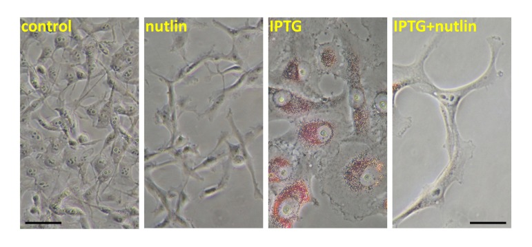 Nutlin-3a decreased lipid accumulation during IPTG-induced senescence