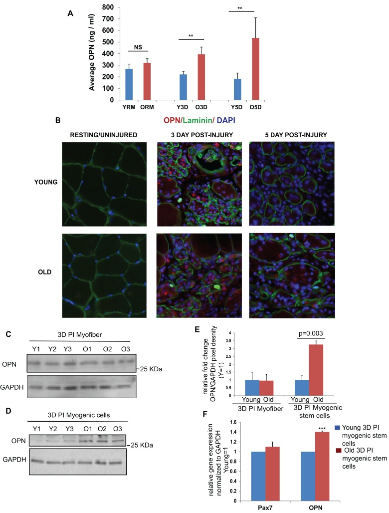 Increased levels of osteopontin in serum and myofiber niche of old mice upon muscle injury