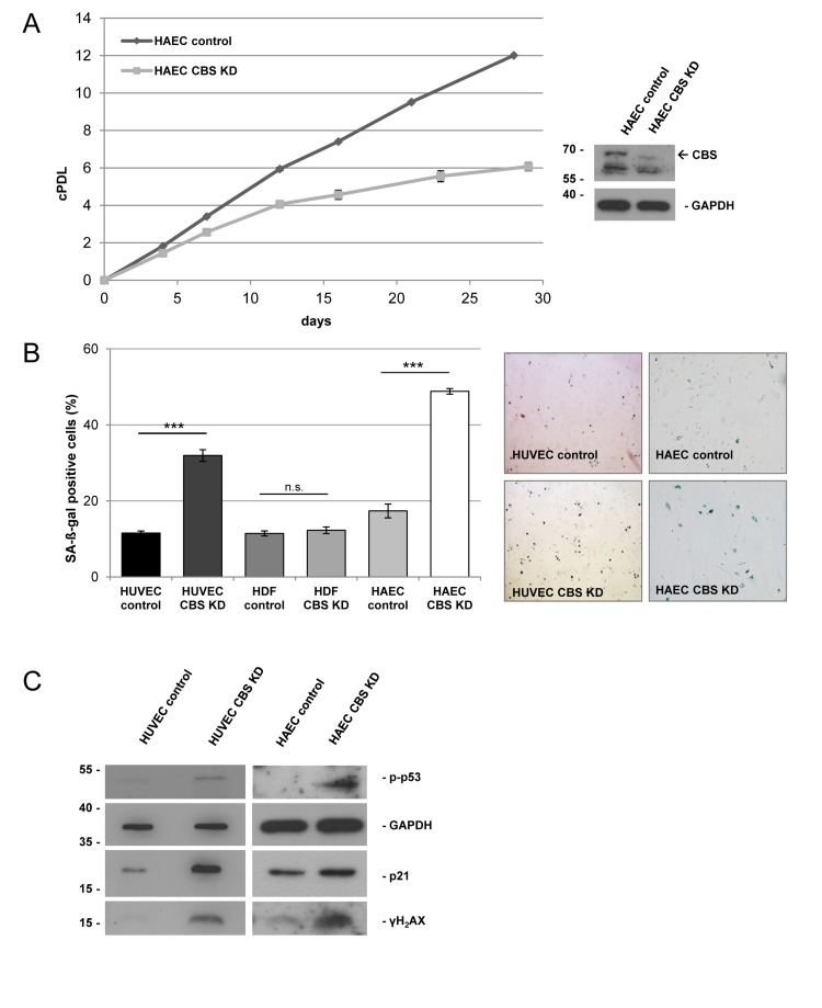 CBS depletion induces premature senescence in human endothelial cells