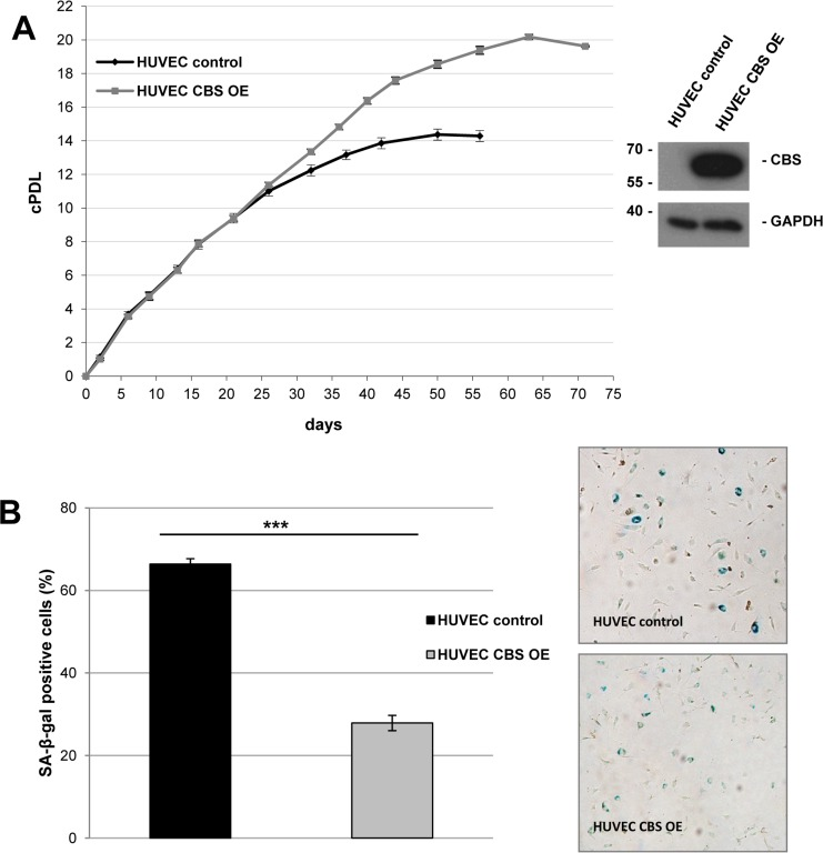 CBS overexpression delays premature senescence in human endothelial cells