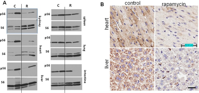 Administration of rapamycin in drinking water inhibits the mTOR pathway in p53+/− male mice