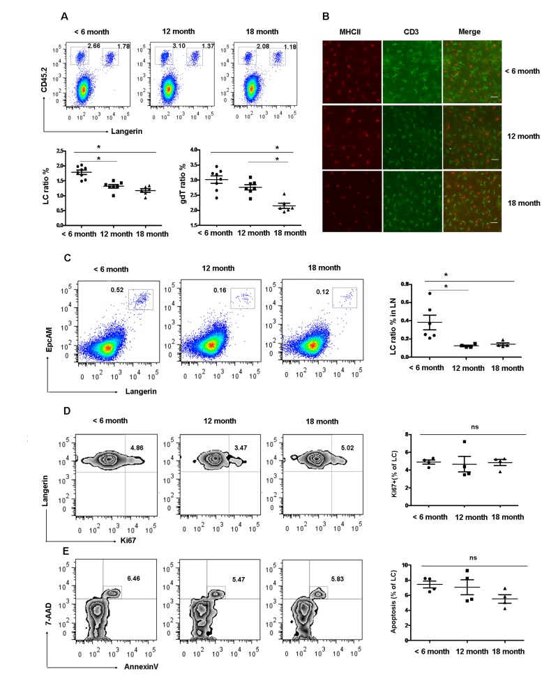 Gradual loss of epidermal LCs during aging development