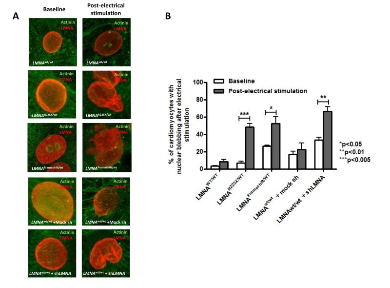 Electrical stimulation inducing nuclear abnormality in cardiomyocytes derived from LMNAR225X/WT &LMNAFrameshift/WT iPSCs