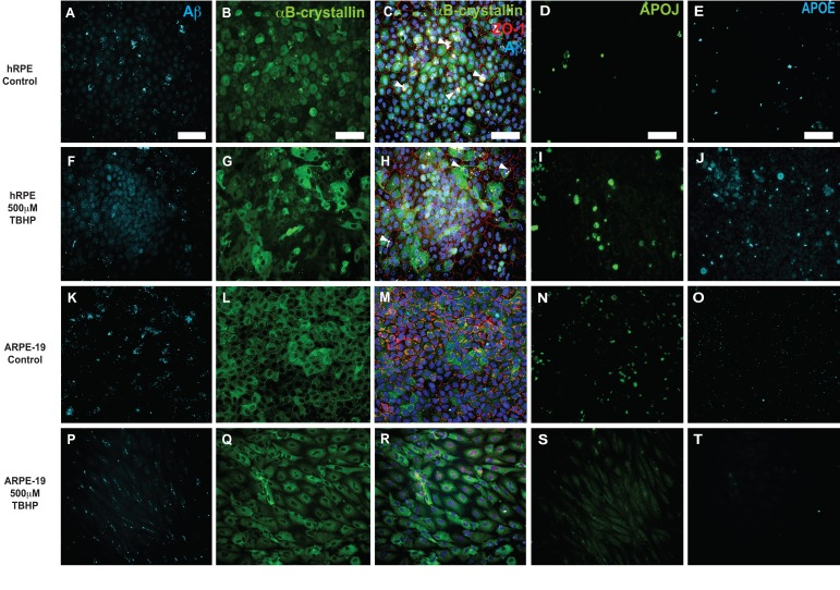 Immunocytochemical detection of drusen-related proteins expressed by hRPE and ARPE-19 cells