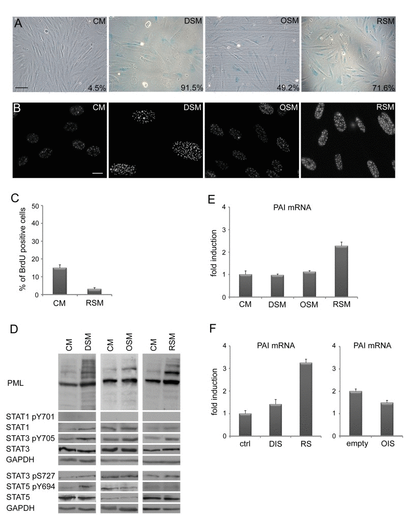 Medium from various types of senescent cells induces senescence in bystander cells