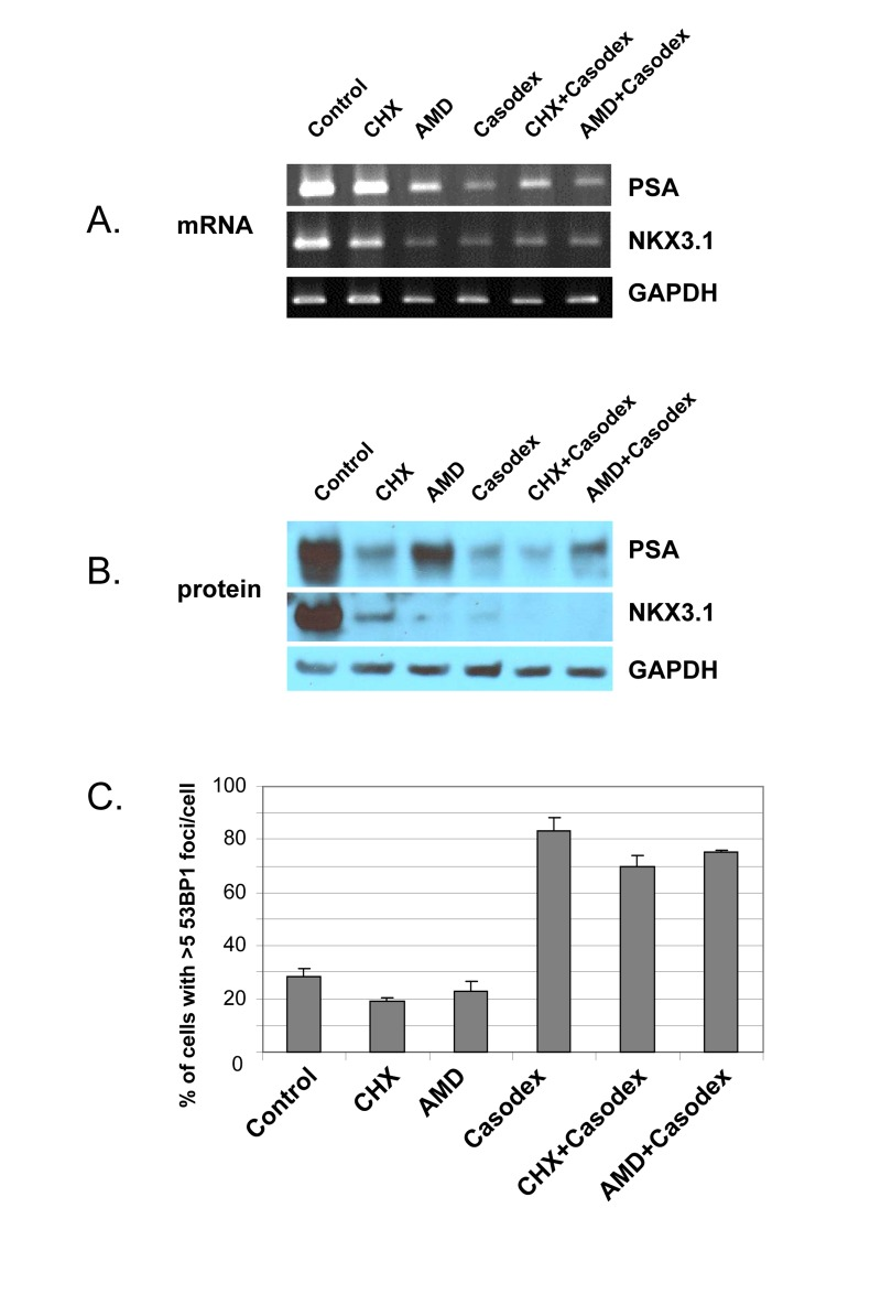 Casodex-induced TIF response in LNCaP cells is not due to inhibition of transcriptional activity or protein translation