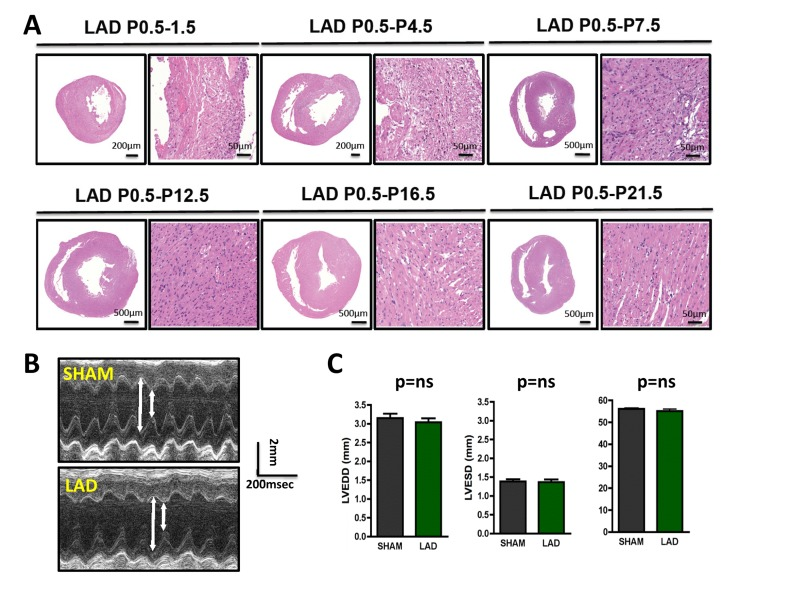 Time-course of cardiac regeneration