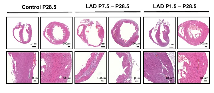 A time window for cardiac regeneration