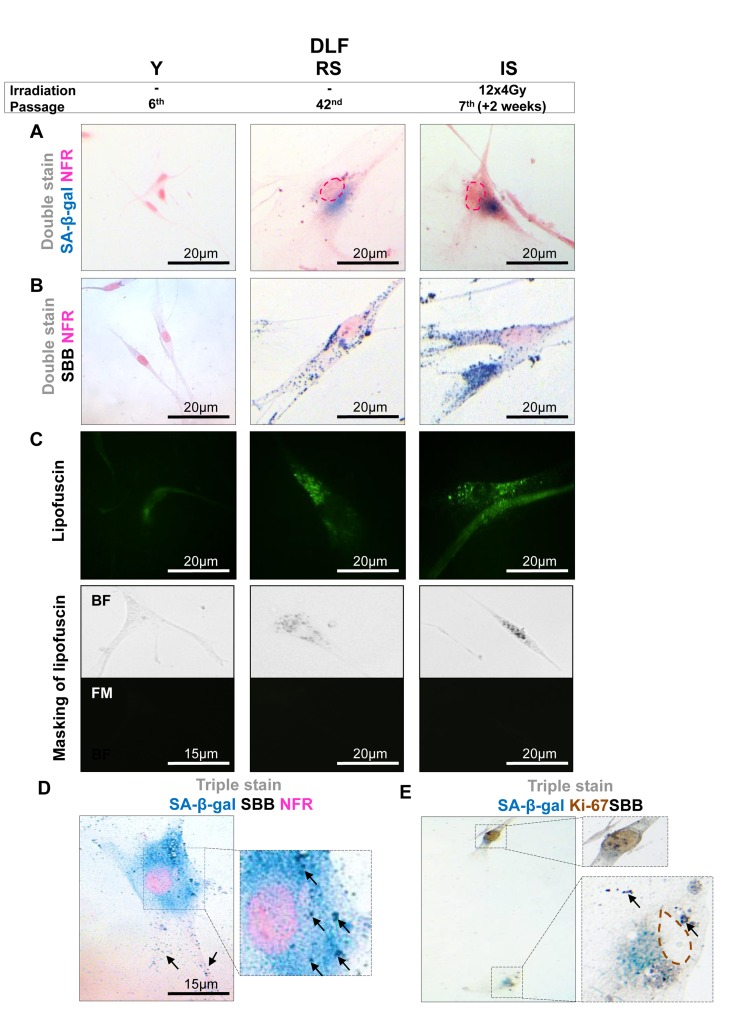 Lipofuscin accumulates and co-localizes with Senescence-Associated beta-galactosidase (SA-β-gal) in sub-confluent senescent primary human diploid lung fibroblasts (DLF)