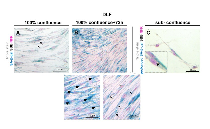 Lipofuscin staining and Senescence-Associated beta-galactosidase (SA-β-gal) activity in primary human diploid lung fibroblasts (DLF)