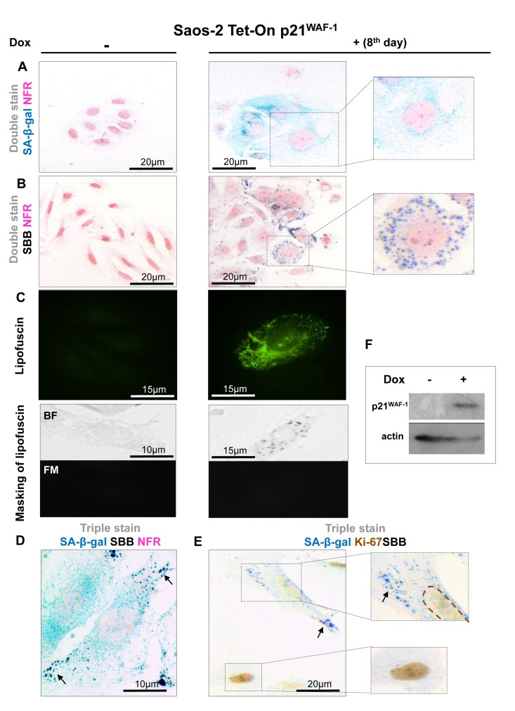 Lipofuscin accumulates and co-localizes with Senescence-Associated beta-galactosidase (SA-β-gal) in senescent Saos-2 cells triggered by p21WAF-1