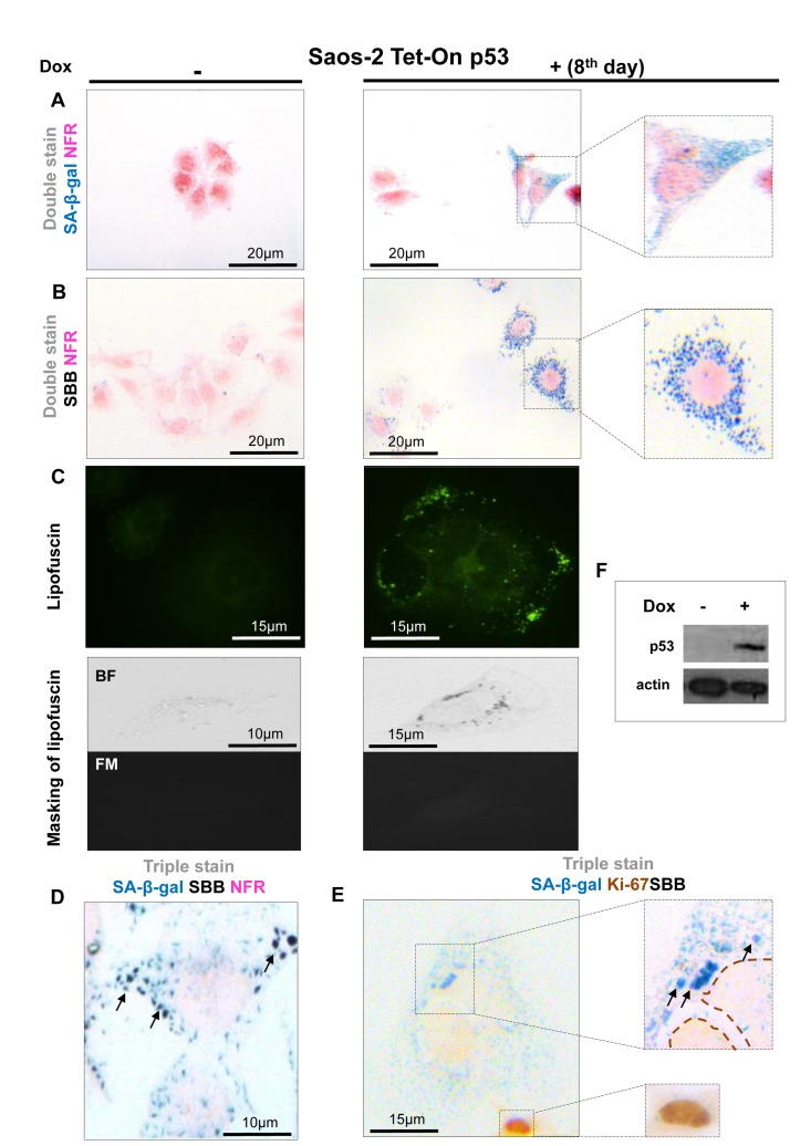 Lipofuscin accumulates and co-localizes with Senescence-Associated beta-galactosidase (SA-β-gal) in p53-mediated Saos-2 senescent cells