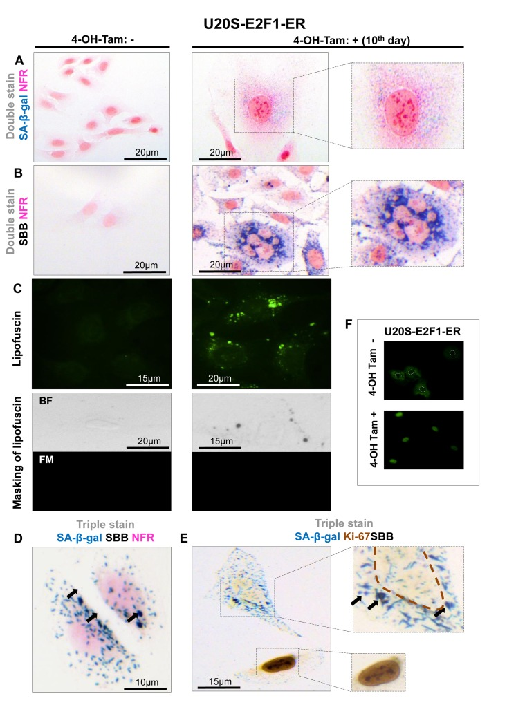 Lipofuscin accumulates and co-localizes with Senescence-Associated beta-galactosidase (SA-β-gal) in E2F-1 induced U2OS senescent cells