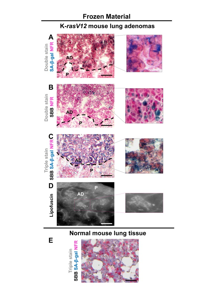 Lipofuscin and Senescence-Associated beta-galactosidase (SA-β-gal) activity co-localize in lung adenomas demonstrating senescence in a mouse model conditionally expressing K-rasV12 in the lung
