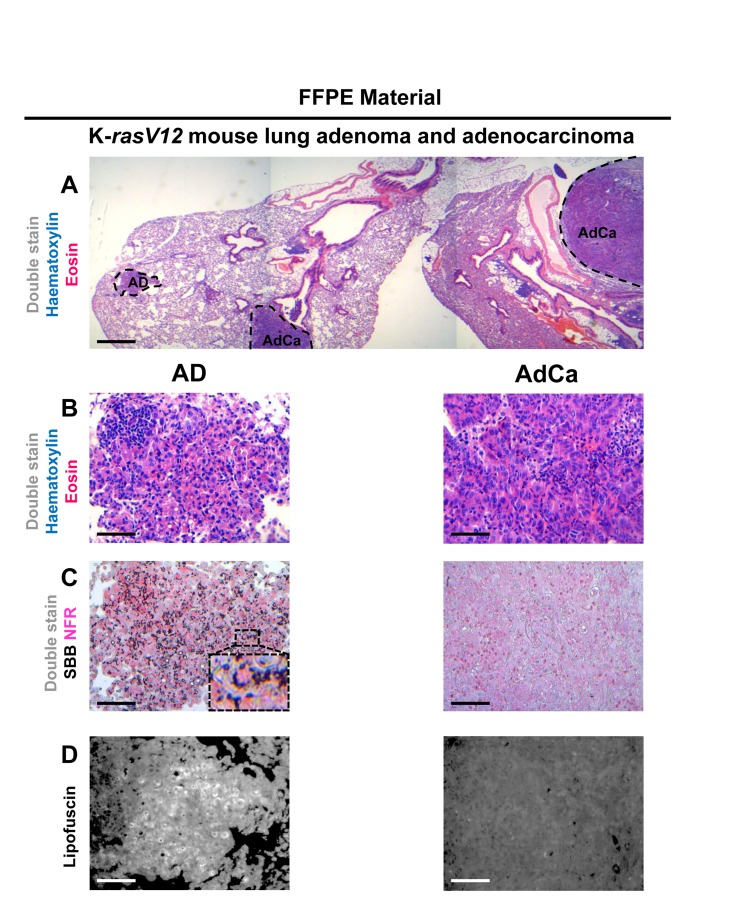 Sudan Black B (SBB) staining demonstrates lipofuscin accumulation in lung adenomas (AD) and absence in adenocarcinomas (AdCa), in formalin-fixed paraffin-embedded (FFPE) lung sections from mice conditionally expressing K-rasV12