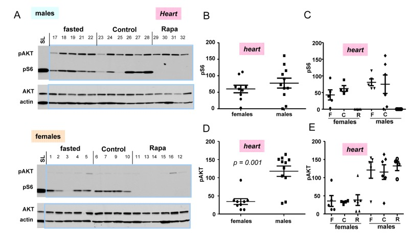 Levels of pS6 and p-AKT in the hearts of 10 months old mice: control, fasted, rapamycin