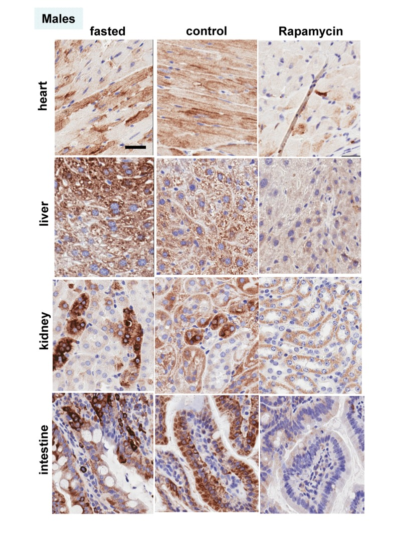 Males: Immunochemistry of pS6 in the organs