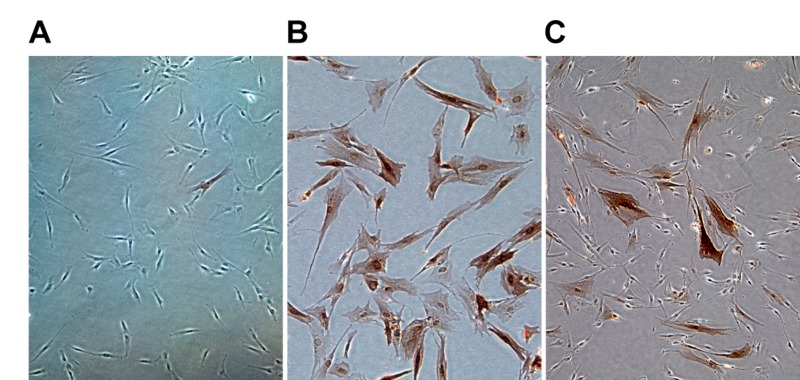 Expression of p16 at the single cell level measured by immunostaining with a p16 antibody followed by immunohistochemical detection