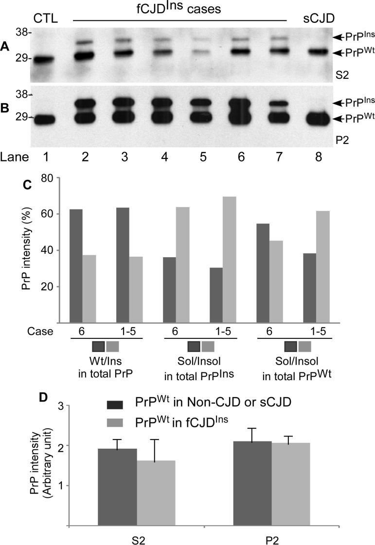 Determination of both PrPWt and PrPIns in detergent-soluble and -insoluble fractions by Western blotting. A and B: After ultracentrifugation in detergents, PrP in the detergent-soluble fraction (S2) (A) and -insoluble fraction (P2) (B) was detected by Western blotting with the anti-PrP antibody anti-N detecting the full-length PrP. Lane1: non-CJD control; Lane 2 fCJDIns+sPrPSc (case 6); Lanes 3 to 7: fCJDIns+rPrPSc (cases 1-5); Lane 8: sCJD control. C: Comparing compositions of total PrP, PrPIns, and PrPWt in fCJDIns+sPrPSc (case 6) and fCJDIns+rPrPSc (cases 1-5, mean) by densitometric analysis of PrP intensity detected with Western blotting as shown in A and B. The left four bars exhibit the percentage of PrPWt or PrPIns in total PrP including soluble and insoluble forms. The central four bars exhibit the percentage of soluble or insoluble form in total PrPIns. The right four bars exhibit the percentage of soluble or insoluble form in total PrPWt. There were no significant differences in the percentage of PrPWt or PrPIns in total PrP between fCJDIns+sPrPSc and fCJDIns+rPrPSc (62.5/37.5 vs 63.4/36.6). Also there were no significant differences in the percentage of the soluble or insoluble form in PrPIns between the two conditions (36.2/63.8 vs 30.5/69.5). In contrast, the percentage of the soluble form of PrPWt was remarkably greater in fCJDIns+sPrPSc than in fCJDIns+rPrP (54.7% vs 38.4%), while the percentage of the insoluble form of PrPWt was significantly smaller in fCJDIns+sPrPSc than in fCJDIns+rPrPSc (45.3% vs 61.6%). D: Comparison of PrPWt intensity in S2 and P2 fractions between fCJDIns and non-CJD or sCJD. No differences in the levels of PrPWt from soluble or insoluble fraction were detected between fCJDIns and non-CJD or sCJD.