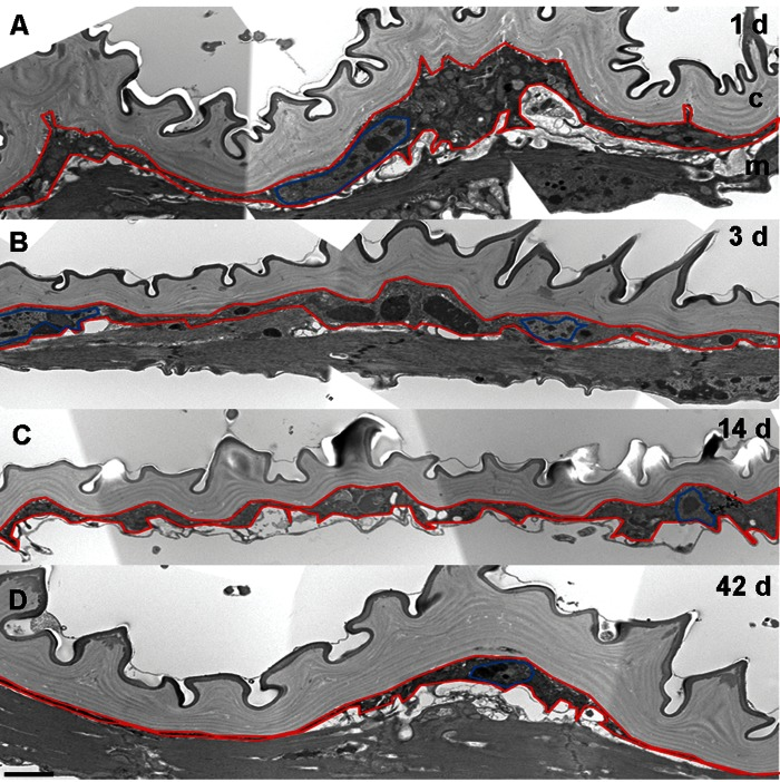 Epidermal Thickness Decreases in Aging Flies