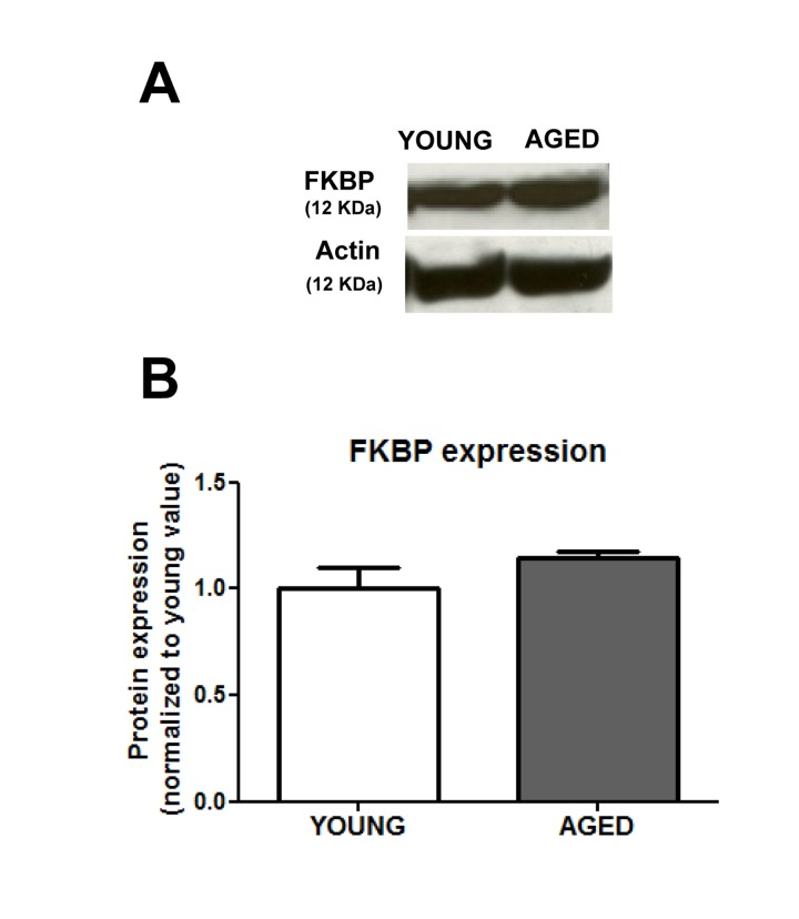 Aging does not change significantly the expression of FKBP12 protein