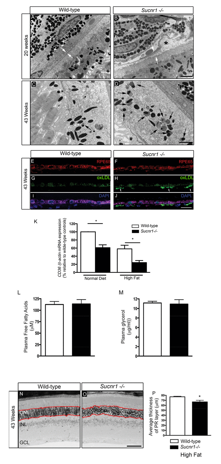 Deficiency in SUCNR1 leads to outer retinal lesions