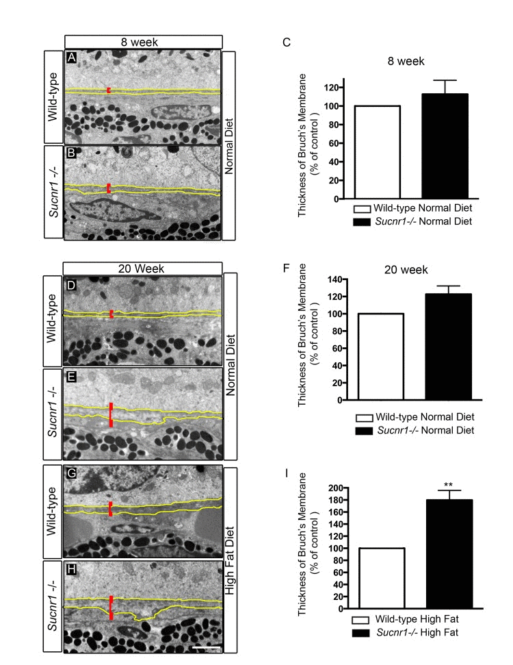 Sucnr1−/− mice develop Bruch's membrane thickening