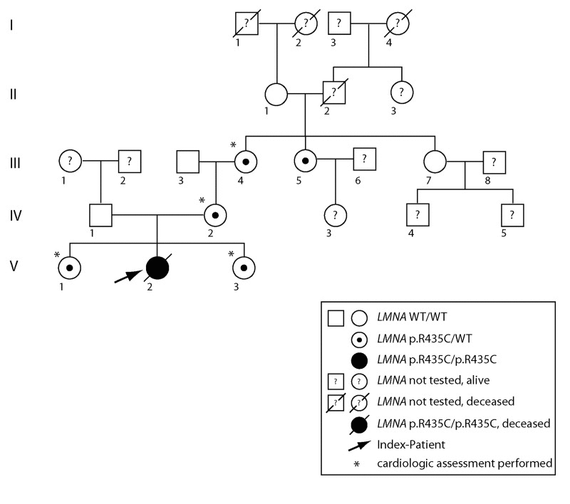 Pedigree of the affected family. Uniparental isodisomy of chromosome 1q21.3- q23.1 (involving the complete LMNA gene), causing homozygosity of autosomal recessively inherited LMNA mutation, was proven for the index patient. Except for the index patient, none of the displayed individuals showed signs of progeroid disease, or signs of progressive cardiac disease. Dilated cardiomyopathy was excluded by echocardiography in individuals labeled by *.