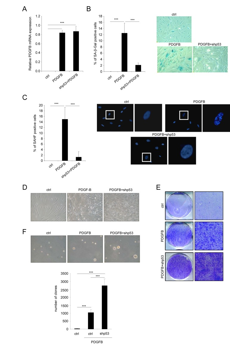 Favoring an escape from PDGFB-induced senescence increases PDGFB-induced transformation