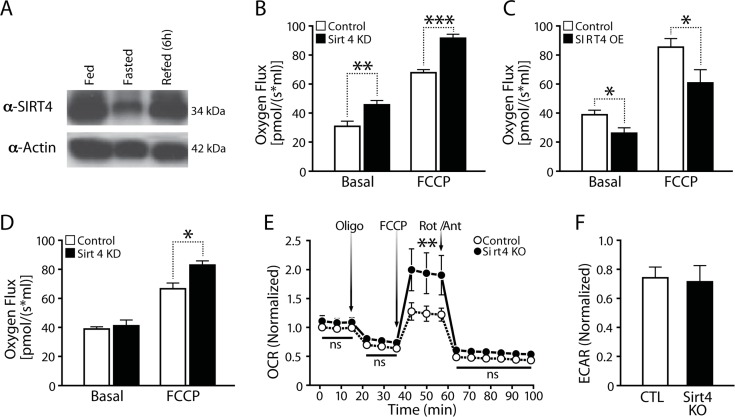 Cellular respiration is negatively associated with Sirt4 expression