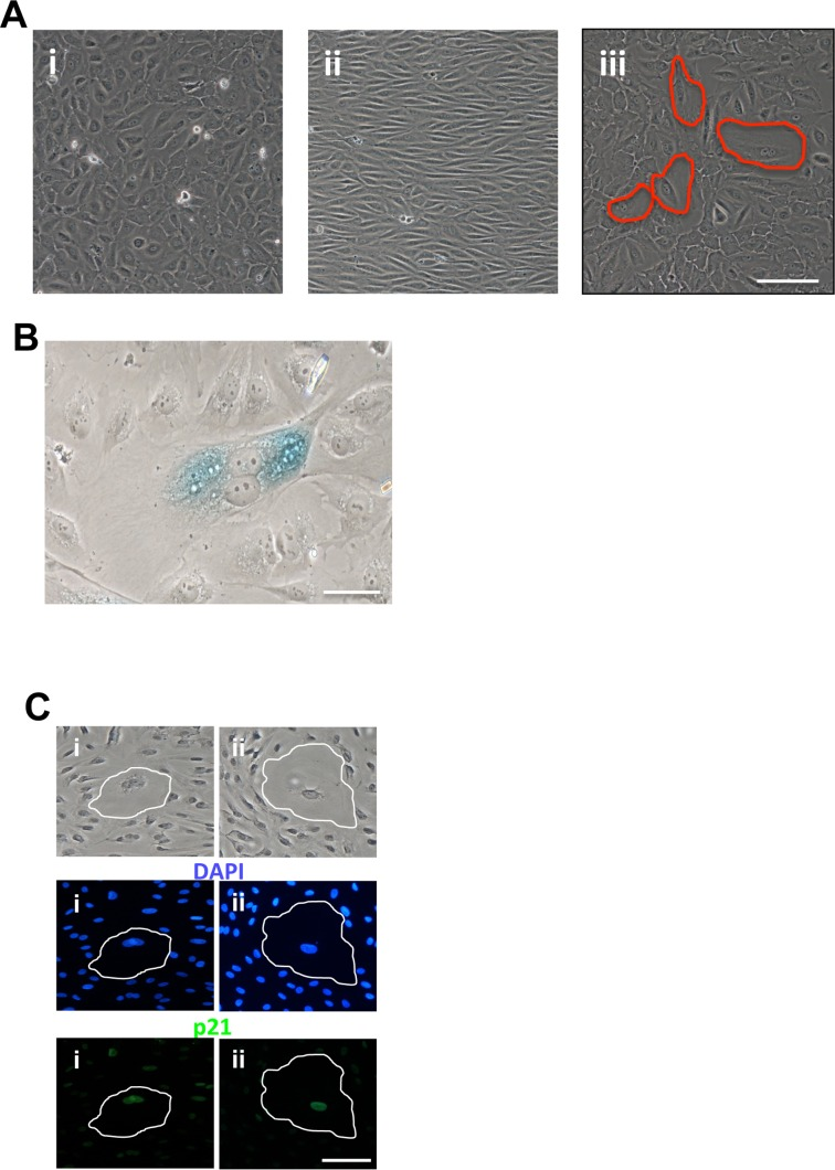 Induction of EC senescence with disturbed flow