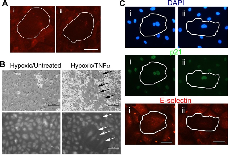 Shear stress and hypoxia induce an anti-inflammatory phenotype