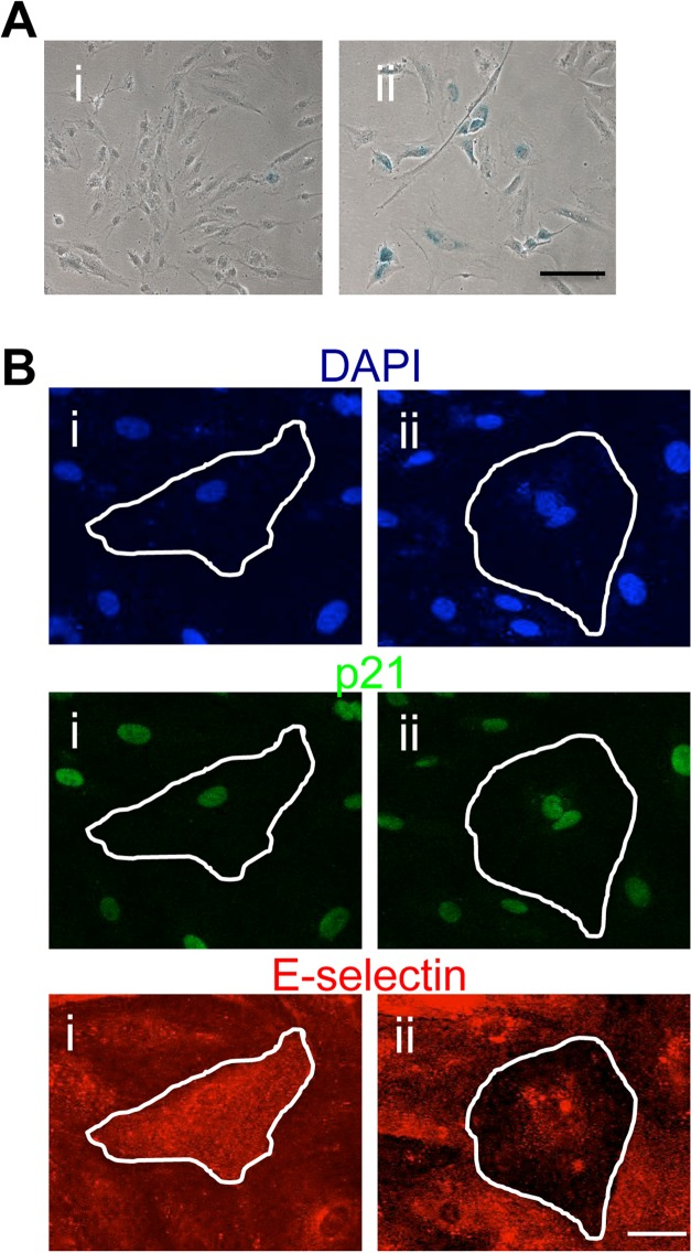 Human coronary artery EC display the anti-inflammatory phenotype