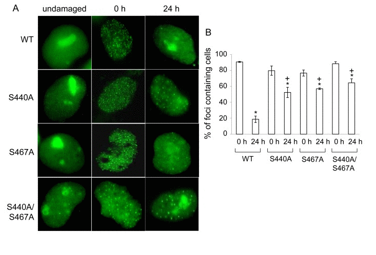 WRN but not phosphorylation mutant relocalizes to the nucleoli post etoposide exposure