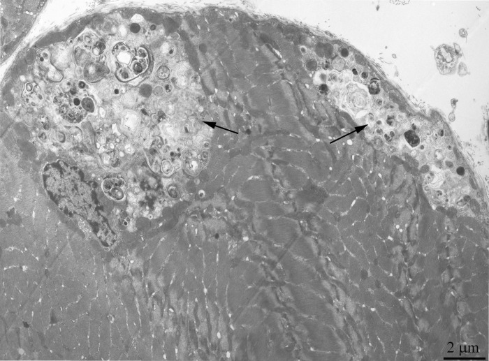 Cross-section of the muscle fiber from a 24-month-old OXYS rat. The arrows, regions occupied with autophagosomes.