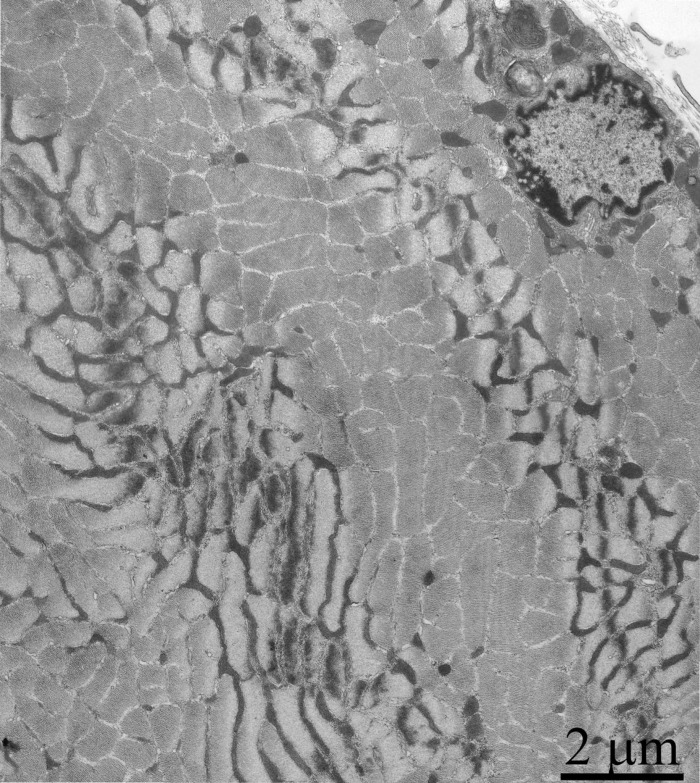 Cross-section of the muscle fiber of a three-month-old OXYS rat treated with SkQ1 (250 nmol/kg) for the last 5 months.