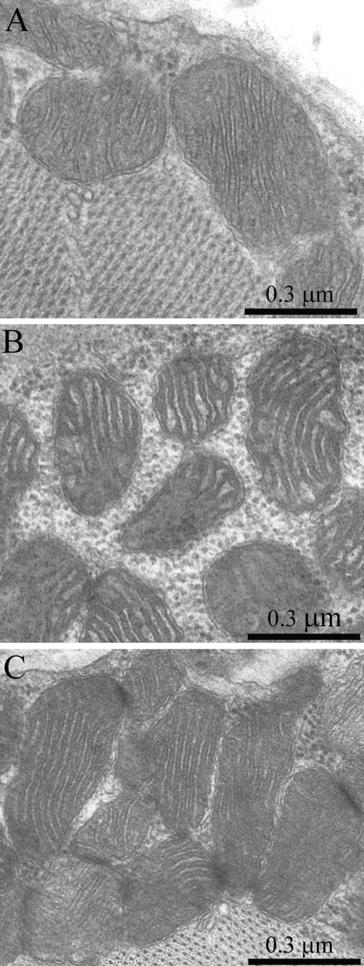 The ultrastructure of skeletal muscle mitochondria of Wistar rats of the age of 3 months (A), of 24 months (B); of 24 months treated with SkQ1 (250 nmol/kg) for the last 5 months (C).