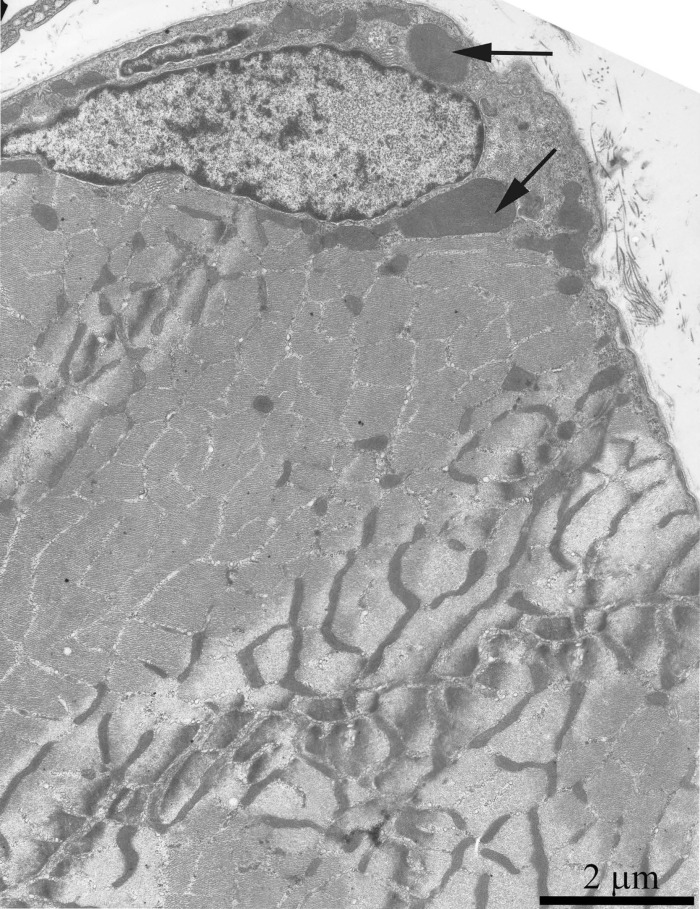 Cross-section of the muscle fiber of a three-month-old OXYS rat. The arrows indicate mitochondria which are significantly larger than the usual organelles.