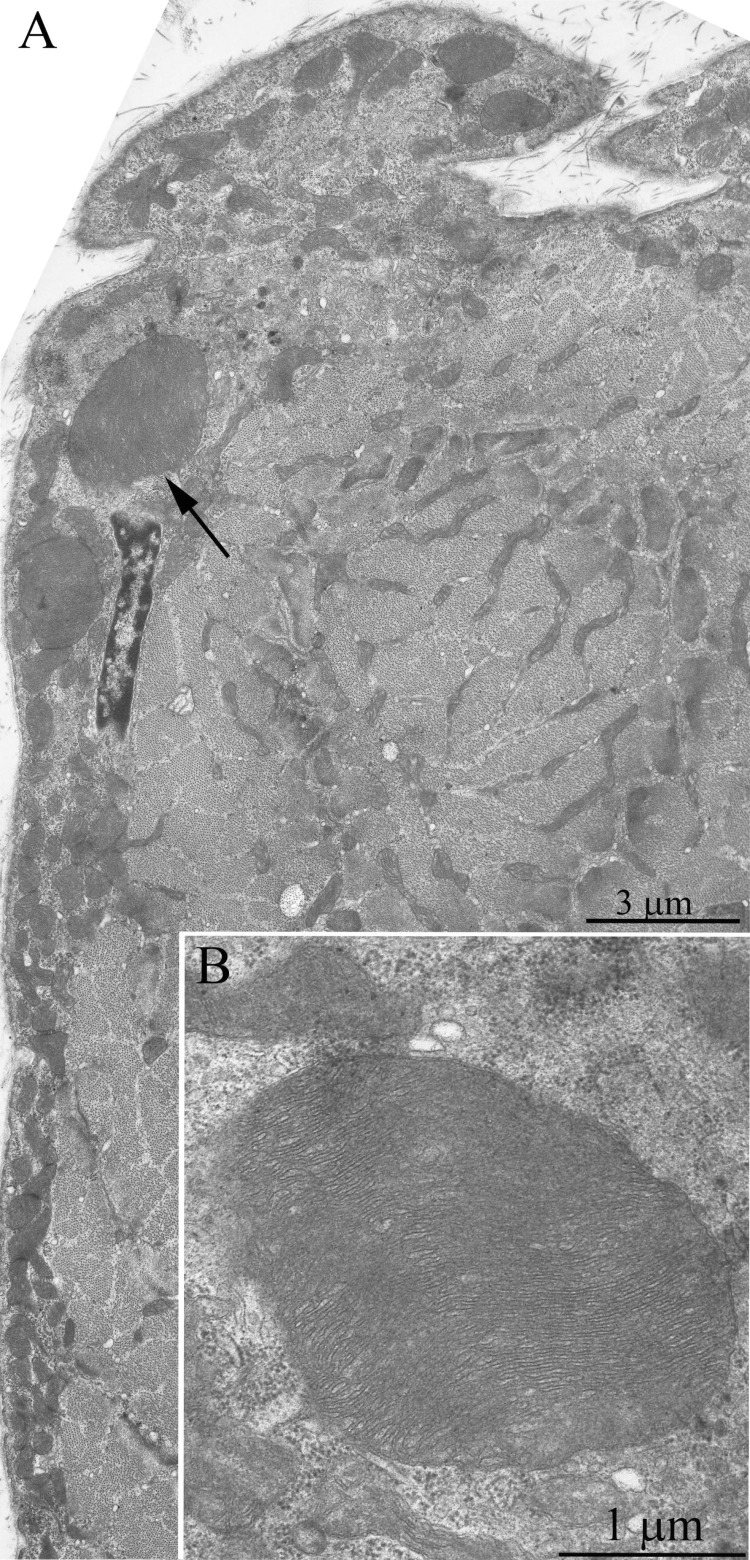 (A) Cross-section of the muscle fiber of a three-month-old OXYS rat. See large mitochondria in the nucleous region (one of them is indicated with the arrow). (B) a large mitochondrion at higher magnification.