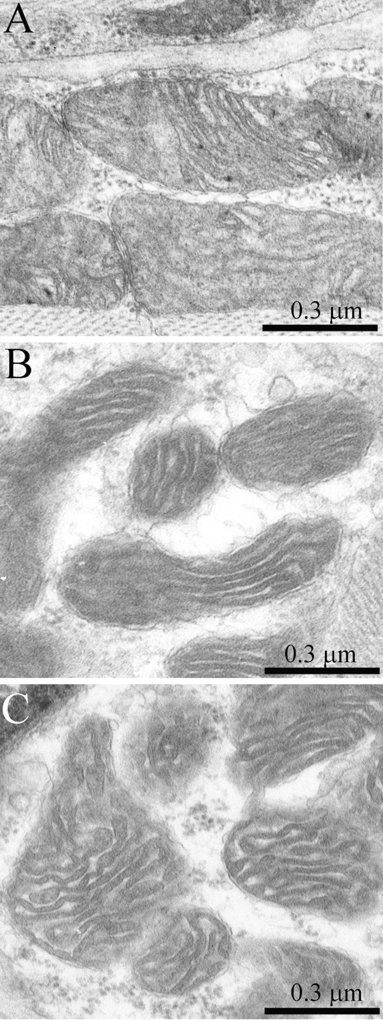 The ultrastructure of skeletal muscle mitochondria of OXYS rats of the age of three months (A), 24 months (B); 24 months treated with SkQ1(250 nmol/kg) for the last 5 months (C).