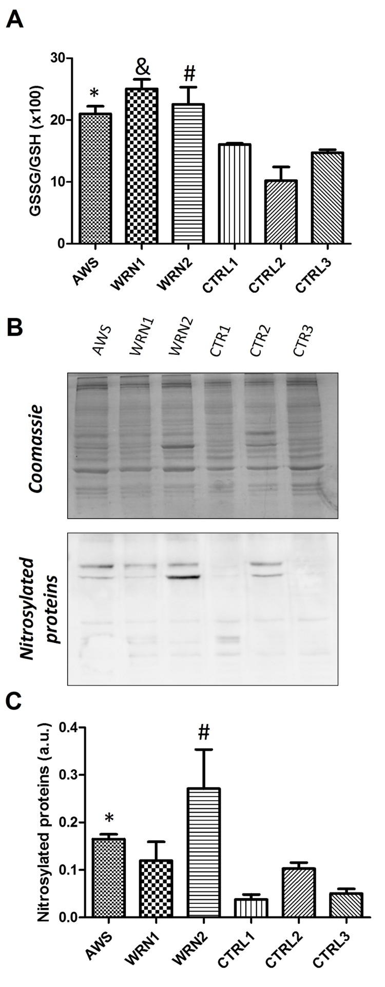 Analysis of the GSH antioxidant levels and Nitro-Tyr levels in atypical Werner syndrome and Werner syndrome fibroblasts