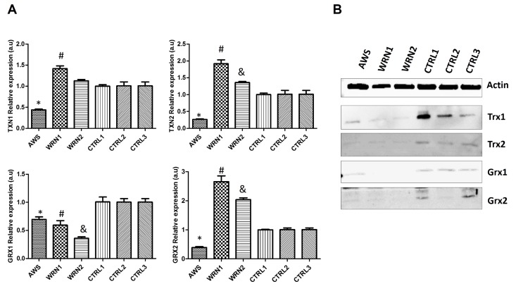 Analysis of the Trx and Grx family proteins in atypical Werner syndrome and Werner syndrome fibroblasts