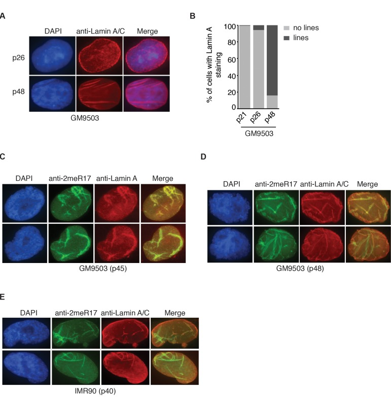 The altered nuclear staining of methylated TRF2 is associated with altered nuclear structure in senescent cells. (A) Analysis of indirect immunofluorescence with anti-Lamin A/C antibody on young (p26) and senescent GM9503 (p48) cells. Cell nuclei were stained with DAPI in blue. (B) Quantification of percentage of GM9503 cells showing nuclear Lamin A staining that are either line-shaped or not associated with lines. A total number of 1014, 1050 and 1073 cells were scored for passages 21, 26 and 48, respectively. (C) Analysis of dual indirect immunofluorescence in late passage GM9503 (p45) with anti-TRF2-2meR17 antibody in conjunction with anti-Lamin A antibody. Cell nuclei were stained with DAPI in blue. (D) Analysis of dual indirect immunofluorescence in senescent GM9503 (p48) with anti-TRF2-2meR17 antibody in conjunction with anti-Lamin A/C antibody. Cell nuclei were stained with DAPI in blue. (E) Analysis of dual indirect immunofluorescence in senescent IMR90 (p40) with anti-TRF2-2meR17 antibody in conjunction with anti-Lamin A/C antibody. Cell nuclei were stained with DAPI in blue.